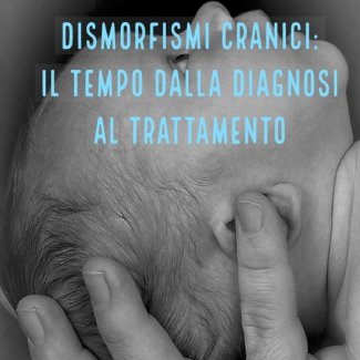 Le plagiocefalie: il tempo dalla diagnosi al trattamento